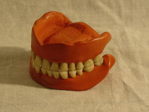 You have choices when thinking about dental implants in SF.