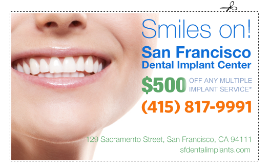 Affordable, even Cheap Dental Implants for Multiple Services