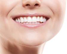 Dental Implant Center in Noe Valley